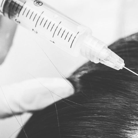 Platelet-Rich-Plasma (PRP) Hair Growth Therapy
