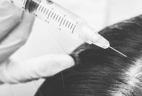 Platelet-Rich-Plasma (PRP) Hair Growth Therapy