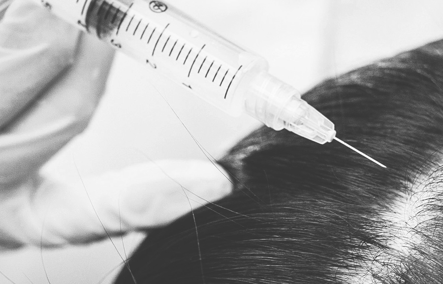 Platelet-Rich-Plasma (PRP) Hair Growth Therapy